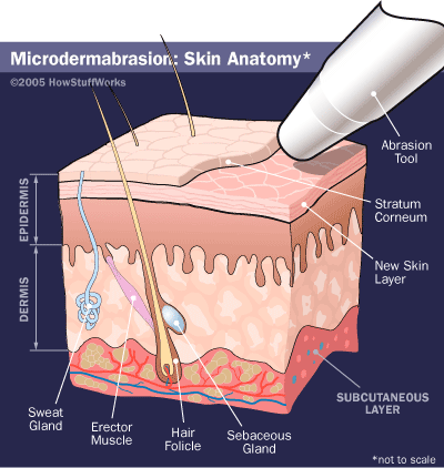 Forehead Lump Under Skin