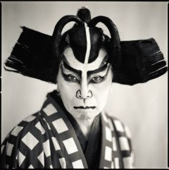 Kabuki Face Syndrome